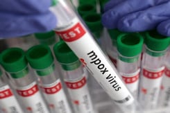 "Prevent Undue Panic": Centre's Advisory To States On Mpox "Prevent Undue Panic": Centre's Advisory To States On Mpox