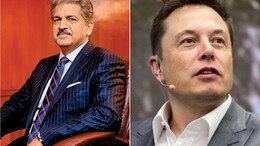 "If This Device Lives Up...": Anand Mahindra On Elon Musk's Neuralink Blindsight Device
