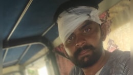 Rajasthan: युवक ने किया था प्रेम विवाह, बजार में अकेला देख युवती के परिजनों ने लाठी-सरियों से पीटा&nbsp;
