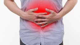 Ulcerative Colitis: Signs, Causes, Prevention Tips & Treatment