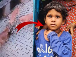 Bharatpur: 5 साल की मासूम बनी आवारा कुत्तों का शिकार, जमीन पर पटक-पटक कर पंजों से बुरी तरह नोचा