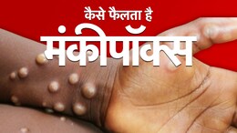 Mpox Virus: दुनिया में कितनी तेजी से फैल रहा है मंकीपॉक्स, टीकाकरण है कितना कारगर उपाय