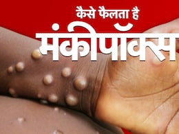 Mpox Virus: दुनिया में कितनी तेजी से फैल रहा है मंकीपॉक्स, टीकाकरण है कितना कारगर उपाय Mpox Virus: दुनिया में कितनी तेजी से फैल रहा है मंकीपॉक्स, टीकाकरण है कितना कारगर उपाय