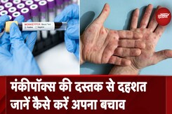 Monkey Pox Virus: भारत में मंकीपॉक्स की दस्तक से सहमे लोग, सरकार सतर्क, जान लें बचाव के तरीके Monkey Pox Virus: भारत में मंकीपॉक्स की दस्तक से सहमे लोग, सरकार सतर्क, जान लें बचाव के तरीके