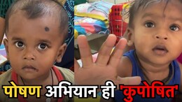 40 % बच्चे बौने, 27% का वजन कम, 8 रुपये में MP के नौनिहाल कैसे बनेंगे बलवान ?