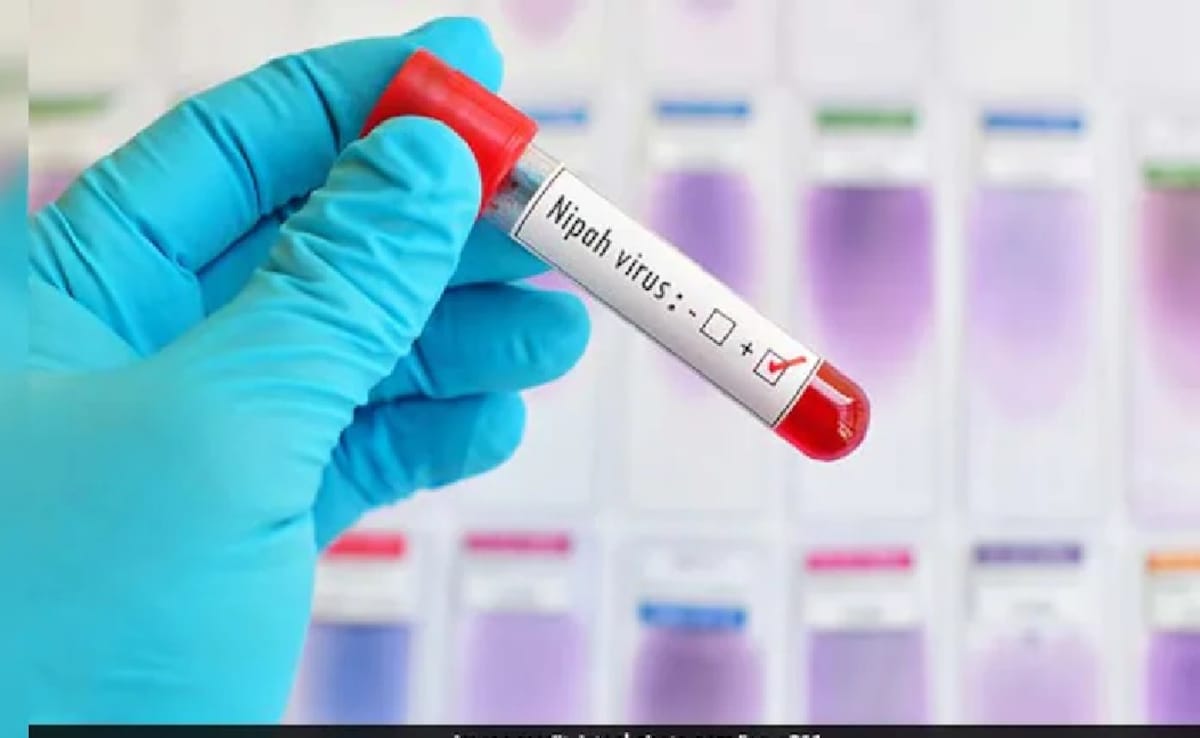 Nipah Virus Crisis: Doctor Urges Global Preparedness Against Possible Spread