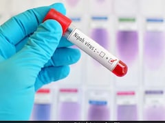 Nipah Virus Crisis: Doctor Urges Global Preparedness Against Possible Spread