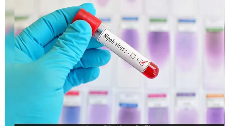 Nipah Virus Update: Bats At Alipore Zoo Kolkata Being Tested For Virus