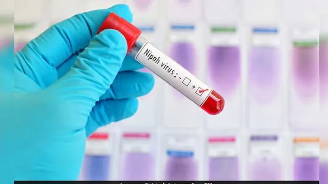 New Nipah Vaccine Proves Safe, Triggers Antibodies In Phase 1 Results: Lancet Study