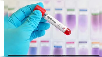 No Need To Panic After Nipah Virus Outbreak In India: South Africa