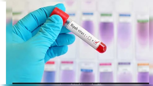 No Need To Panic After Nipah Virus Outbreak In India: South Africa