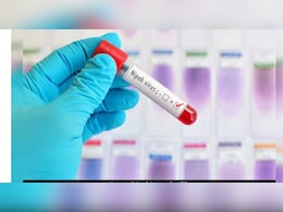 निपाह वायरस: जांच में 13 लोगों की रिपोर्ट निगेटिव, कितना खतरनाक है यह वायरस? निपाह वायरस: जांच में 13 लोगों की रिपोर्ट निगेटिव, कितना खतरनाक है यह वायरस?