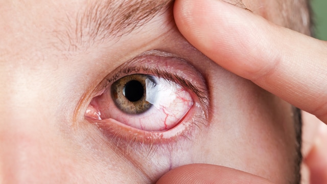 Wear wraparound sunglasses or goggles to shield your eyes from cold wind