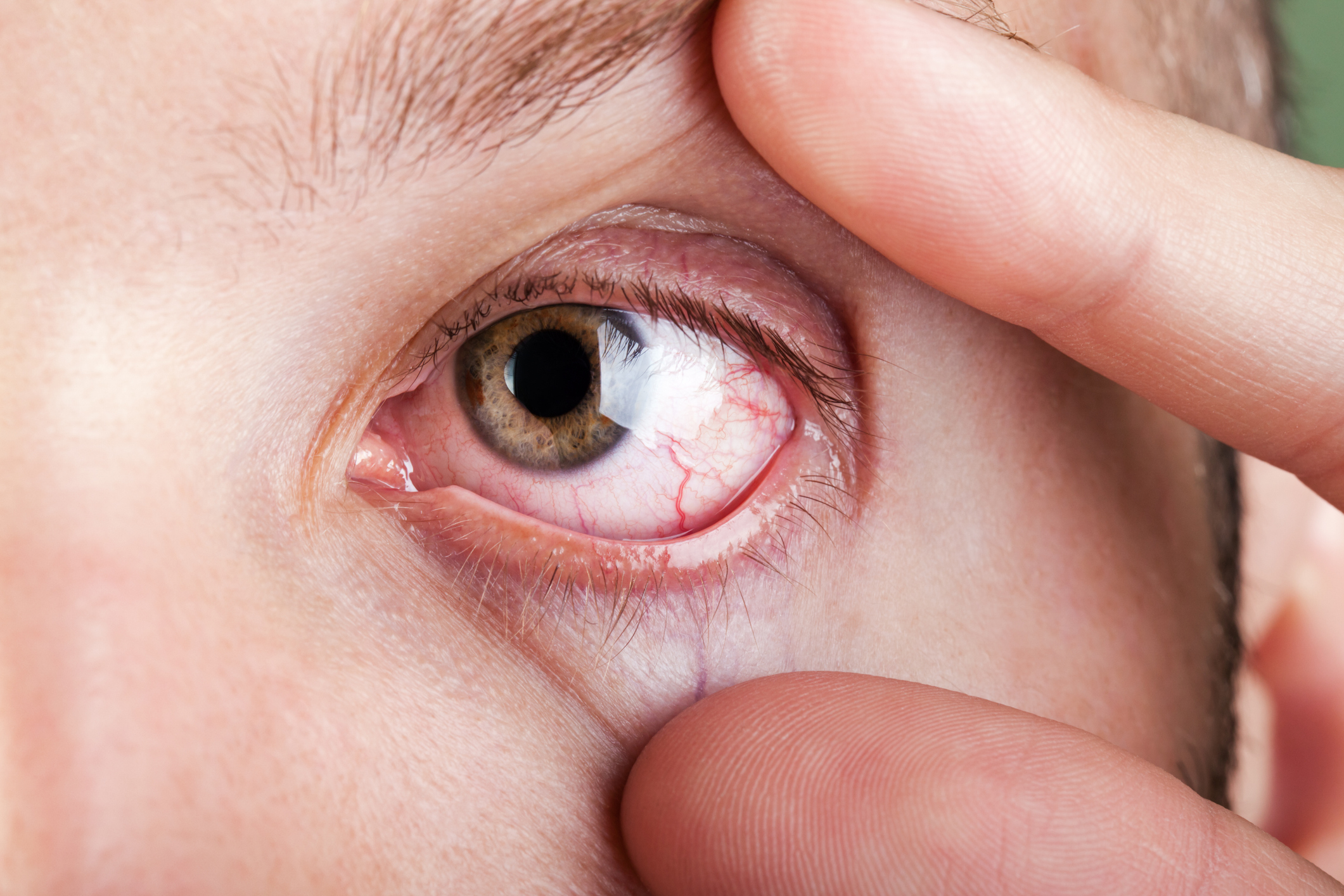 Wear wraparound sunglasses or goggles to shield your eyes from cold wind