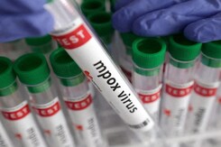 India Reports First Suspected Monkeypox Case India Reports First Suspected Monkeypox Case