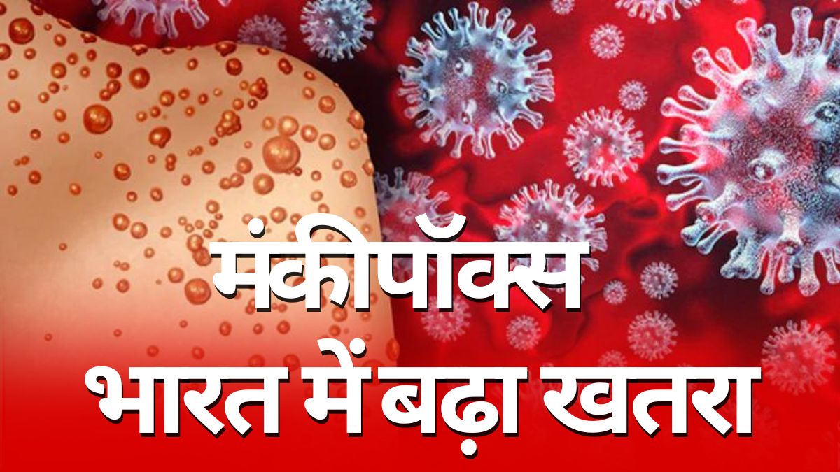 जिसका डर था वही हुआ, भारत पहुंचा मंकीपॉक्स का 'शैतान' वैरिएंट, जानिए कितना खतरनाक