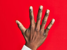 उंगल‍ियों के काले पोर हो सकते हैं डायब‍िटीज के लक्षण, क्या दोनों हाथों में दाग का अलग-अलग मतलब होता है?
