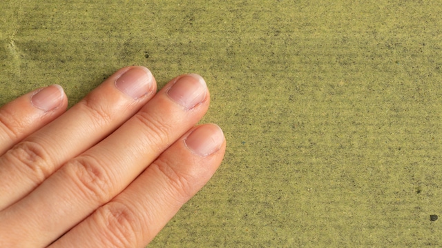 In case of any prolonged abnormalities occurring on your nails, contact a healthcare professional