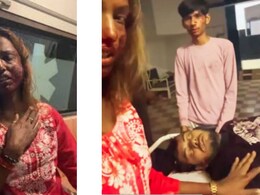एक्सीडेंट में यूट्यूबर की टूटी हड्डी, मुंह से टपकता रहा खून, फिर भी इलाज कराने की जगह बनाती रही रील
