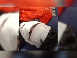 Phalodi News: महिला के पहले पति ने दूसरे पति की काट दी नाक, दो बच्चों के जन्म के बाद की थी दूसरी शादी