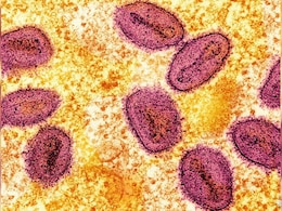 Mpox को WHO ने करार दिया पब्लिक हेल्थ इमरजेंसी, जानिए भारत में क्या हैं हालात Mpox को WHO ने करार दिया पब्लिक हेल्थ इमरजेंसी, जानिए भारत में क्या हैं हालात