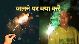 Diwali : दिवाली पर पटाखों से जलने पर सबसे पहला काम ये करें