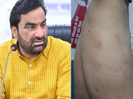 RLP कार्यकर्ता की थाने में की गई पिटाई, फिर मिली धमकी, हनुमान बेनीवाल ने दी बड़ी चेतावनी