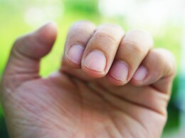 5 Things Your Nails Are Telling You About Your Health, As Shared By A Nutritionist