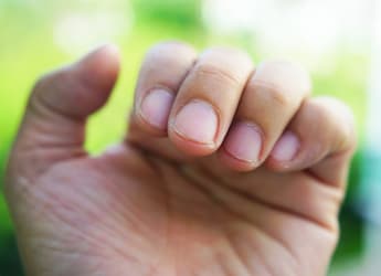 5 Things Your Nails Are Telling You About Your Health, As Shared By A Nutritionist 5 Things Your Nails Are Telling You About Your Health, As Shared By A Nutritionist