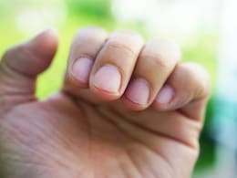 नाखूनों में दिखने वाले ये 10 लक्षण हो सकते हैं गंभीर बीमारी का संकेत, एक्सपर्ट ने बताया कैसे पहचानें