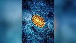 Britain Detects Its 1st Case Of New Mpox Variant