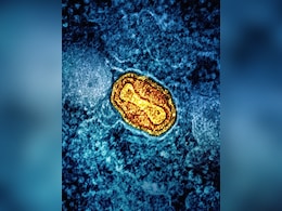 Britain Detects Its 1st Case Of New Mpox Variant Britain Detects Its 1st Case Of New Mpox Variant