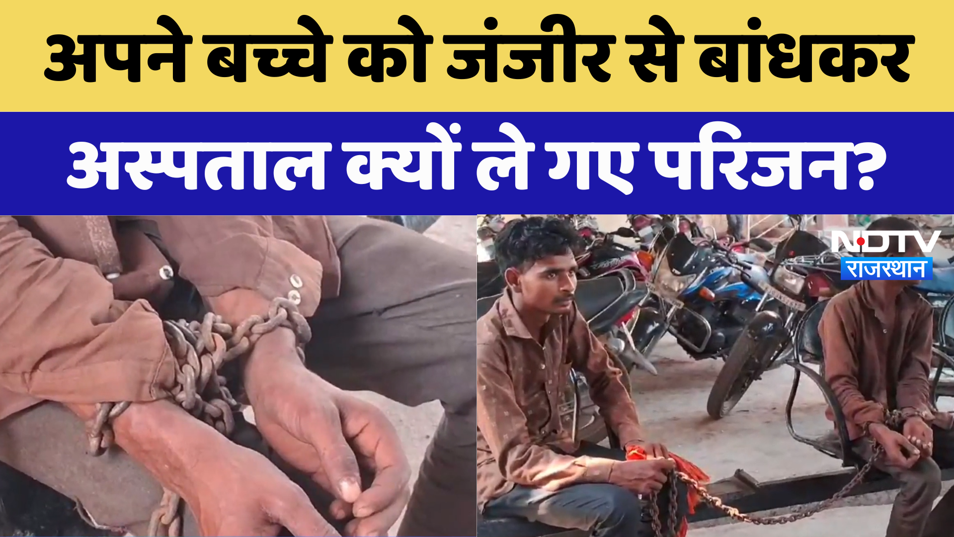 Banswara News : अपने ही बच्चे को जंजीर से बांधकर अस्पताल क्यों ले गए परिजन? | Latest | Rajasthan