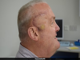 New Treatment Shrinks Man's Aggressive Brain Tumour By Half In Breakthrough Trial New Treatment Shrinks Man's Aggressive Brain Tumour By Half In Breakthrough Trial