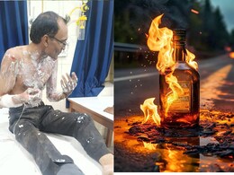 पुष्कर से लौट रहे युवक को जिंदा जलाकर मारने का कोशिश, पहले पीटा फिर डाला पेट्रोल, हालत गंभीर 