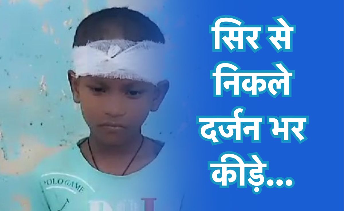 इलाज के दौरान मासूम के सिर से निकले एक दर्जन कीड़े, चित्रकूट के इस आश्रम की दुर्दशा पर उठे सवाल