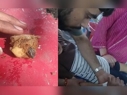 समोसे के अंदर छिपकली !आलू समझकर आधा हिस्सा खा गया बच्चा, सिर देखा तो परिजनों के उड़ गए होश 