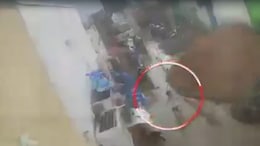 Boy, 2, Attacked By Dogs While Playing Outside Home In Hyderabad