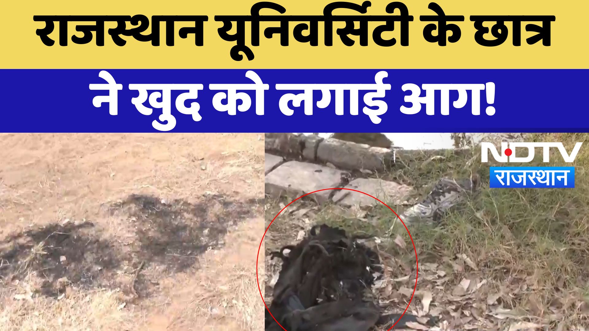 Rajasthan University Student Fire: राजस्थान यूनिवर्सिटी के छात्र ने खुद को लगाई आग | Breaking News