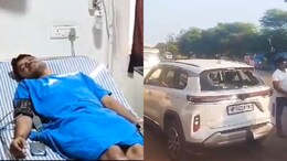 नारकोटिक्स विभाग के SI पर युवती ने किया एसिड अटैक, पुलिस में दोनों ने दर्ज कराया केस