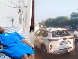 नारकोटिक्स विभाग के SI पर युवती ने किया एसिड अटैक, पुलिस में दोनों ने दर्ज कराया केस