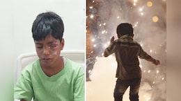 Diwali 2024: पटाखे जलाने से 6 बच्चों के आंखों की रोशनी गई, जयपुर में 80 से ज़्यादा लोग घायल