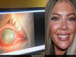 US Woman, 23, Goes Blind In One Eye After Swimming With Contact Lenses: "Most Pain I've Ever Experienced" US Woman, 23, Goes Blind In One Eye After Swimming With Contact Lenses: "Most Pain I've Ever Experienced"