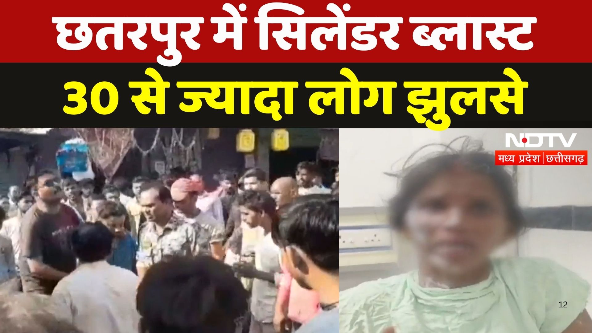 Gas Cylinder Blast in Chhatarpur: छतरपुर में सिलेंडर ब्लास्ट, 30 से ज्यादा लोग झुलसे