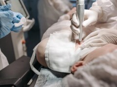 China Woman Dies After 6 Cosmetic Surgeries In A Day, Family Files Lawsuit