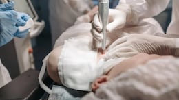 China Woman Dies After Six Cosmetic Surgeries In One Day, Family Seeks Compensation
