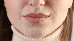 Winter Skin Care Tips : कोरड्या त्वचेमुळे आहात त्रस्त? या सोप्या 3 उपायांमुळे चेहऱ्यावर येईल तेज