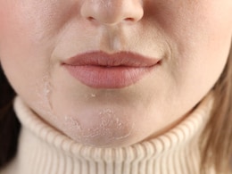 Winter Skin Care Tips : कोरड्या त्वचेमुळे आहात त्रस्त? या सोप्या 3 उपायांमुळे चेहऱ्यावर येईल तेज Winter Skin Care Tips : कोरड्या त्वचेमुळे आहात त्रस्त? या सोप्या 3 उपायांमुळे चेहऱ्यावर येईल तेज