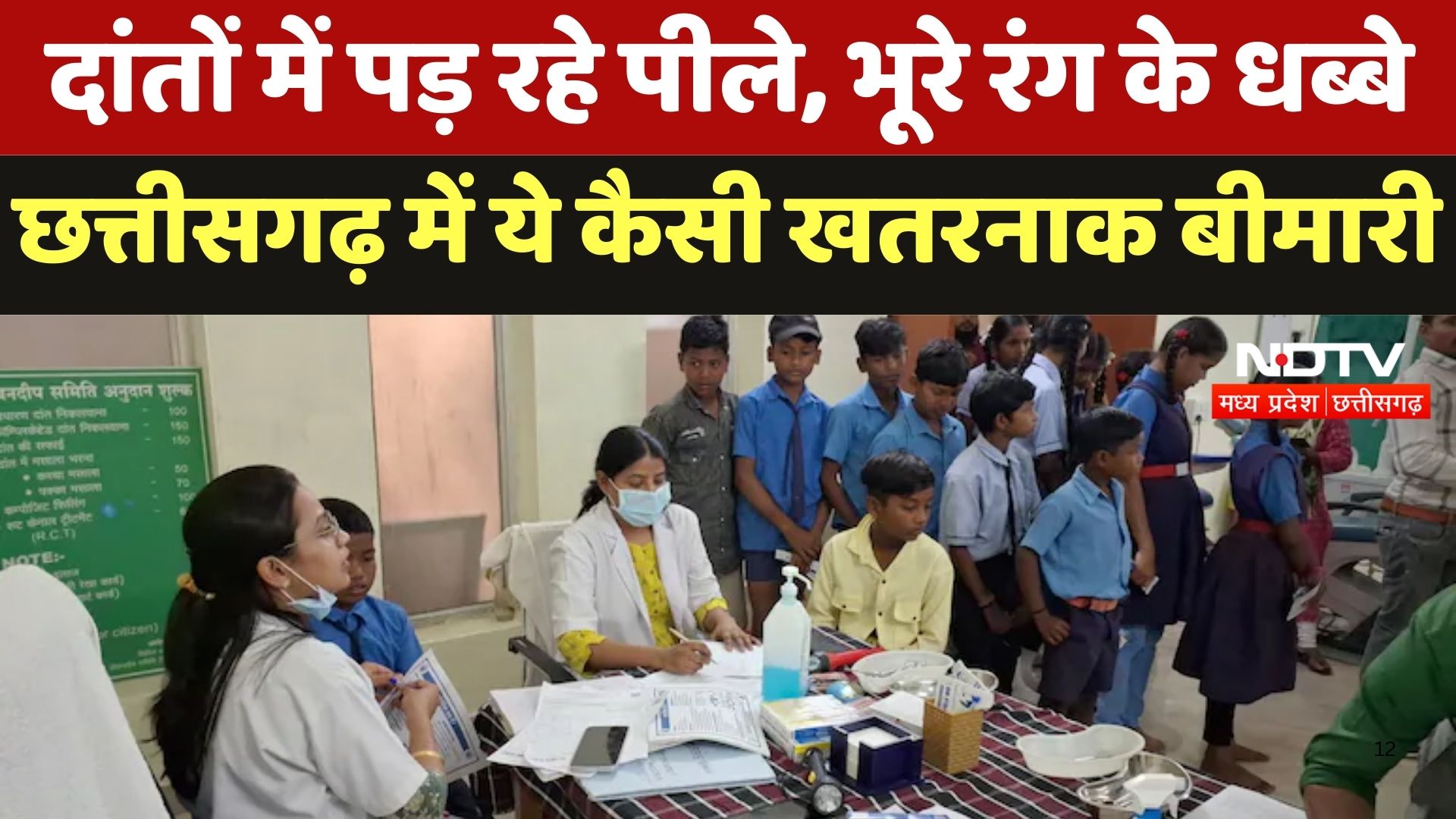 Fluorescence Disease In Kanker 54 villages  दांतों में पड़ रहे पीले, भूरे रंग के धब्बे, Chhattisgarh में ये कैसी खतरनाक बीमारी