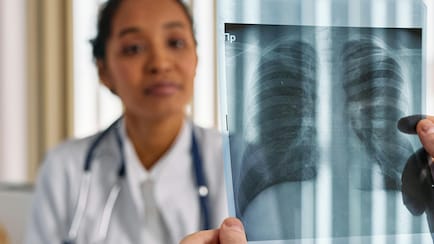 Single-Shot Tuberculosis Prevention, Shorter Treatments: WHO Sets Targets